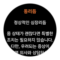'정상적인 심장리듬' 측정 결과 확인