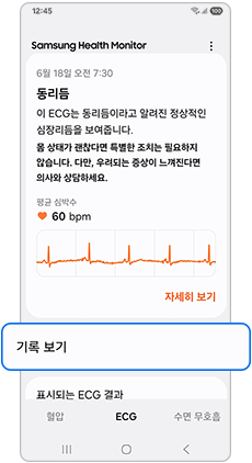 ECG - “기록 보기” 선택  