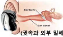 오픈형