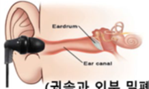 커널형